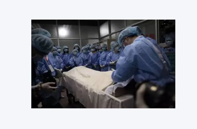 球盟会：D打印技术革新殡葬化妆：让逝者重现微笑新境界(图4)